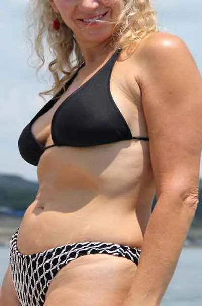Linn Steinsåsen